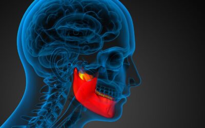 La sindrome temporo mandibolare
